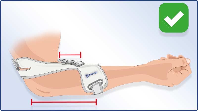 Application instructions Masalo Cuff MED - Correctly applied and distance observed